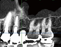 当院の歯科用CT