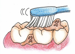 歯の清掃用具