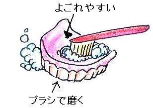 義歯清掃