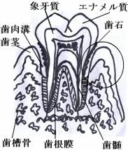 歯周病に罹患した歯周組織
